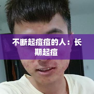 不斷起痘痘的人:長期起痘