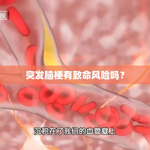 突發腦梗有致命風險嗎？