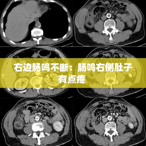 右邊腸鳴不斷:腸鳴右側肚子有點疼