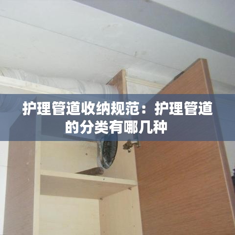 護(hù)理管道收納規(guī)范：護(hù)理管道的分類有哪幾種 