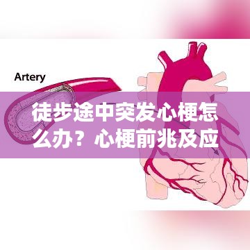 徒步途中突發心梗怎么辦？心梗前兆及應對措施科普！