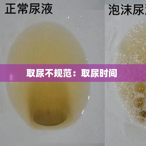 取尿不規(guī)范:取尿時間