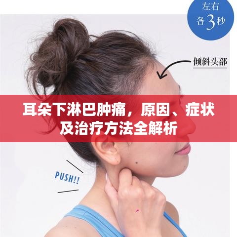 耳朵下淋巴腫痛,原因、癥狀及治療方法全解析