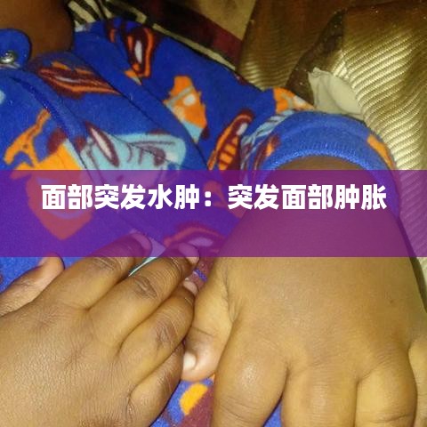 面部突發水腫:突發面部腫脹