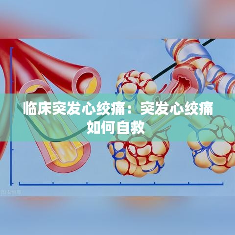 臨床突發心絞痛：突發心絞痛如何自救 