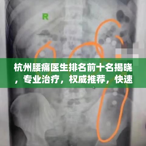 杭州腰痛醫(yī)生排名前十名揭曉,專業(yè)治療,權(quán)威推薦,快速解決您的腰痛問題!