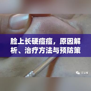 臉上長硬痘痘,原因解析、治療方法與預防策略