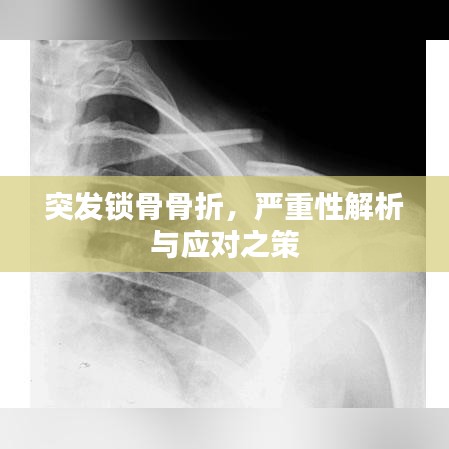 突發鎖骨骨折,嚴重性解析與應對之策