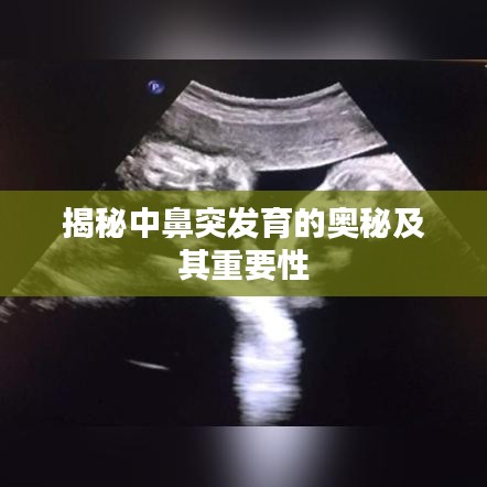 揭秘中鼻突發育的奧秘及其重要性
