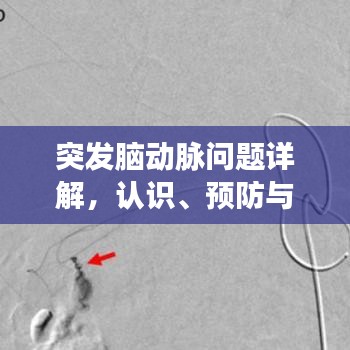 突發(fā)腦動脈問題詳解,認識、預(yù)防與治療策略