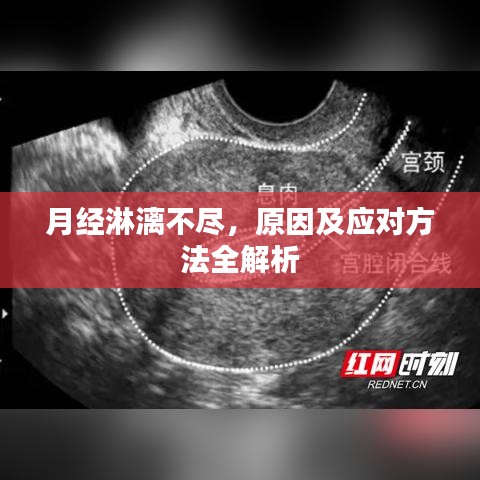 月經淋漓不盡，原因及應對方法全解析