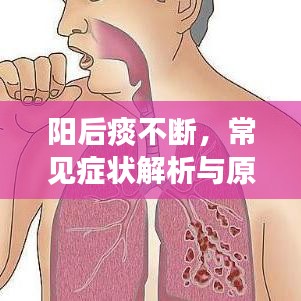 陽后痰不斷,常見癥狀解析與原因探究