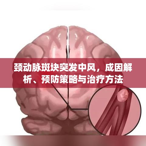 頸動(dòng)脈斑塊突發(fā)中風(fēng),成因解析、預(yù)防策略與治療方法